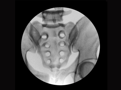 c-duga zmenshennya sumu