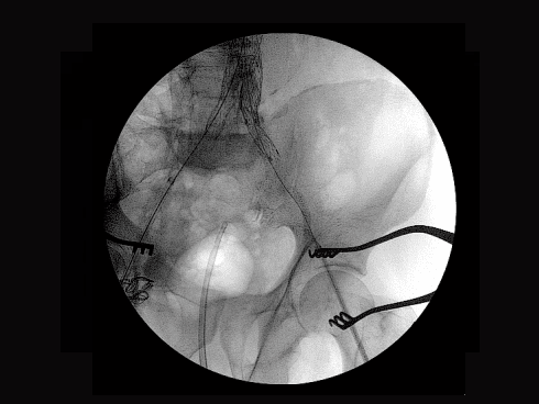 c-duga pidsvichenya-krayiv