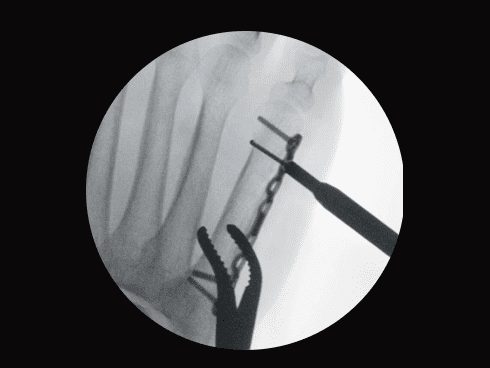 carmex fr avtoregulyacia