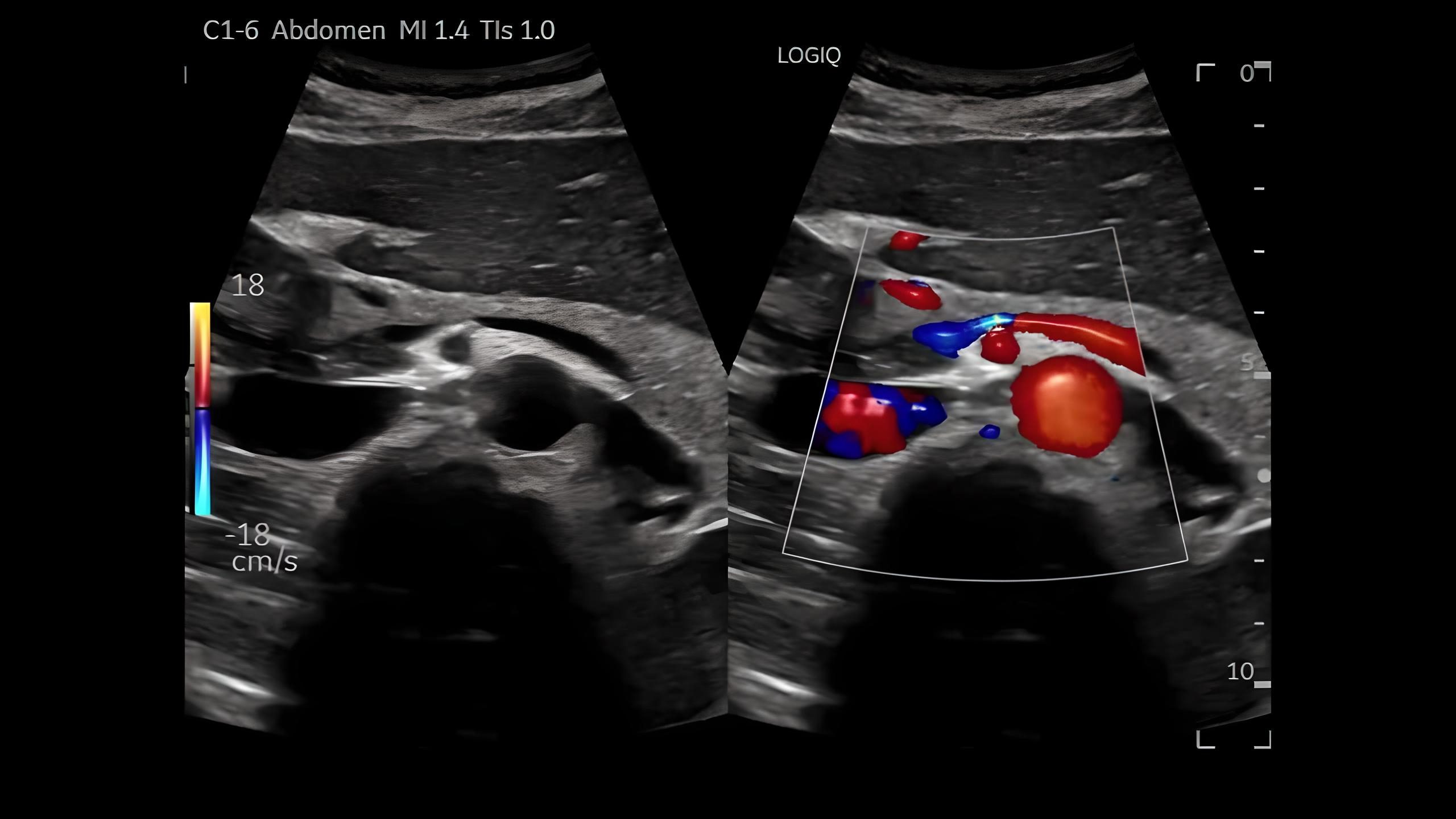 Dual Mode, Pancreas, C1-6-D
