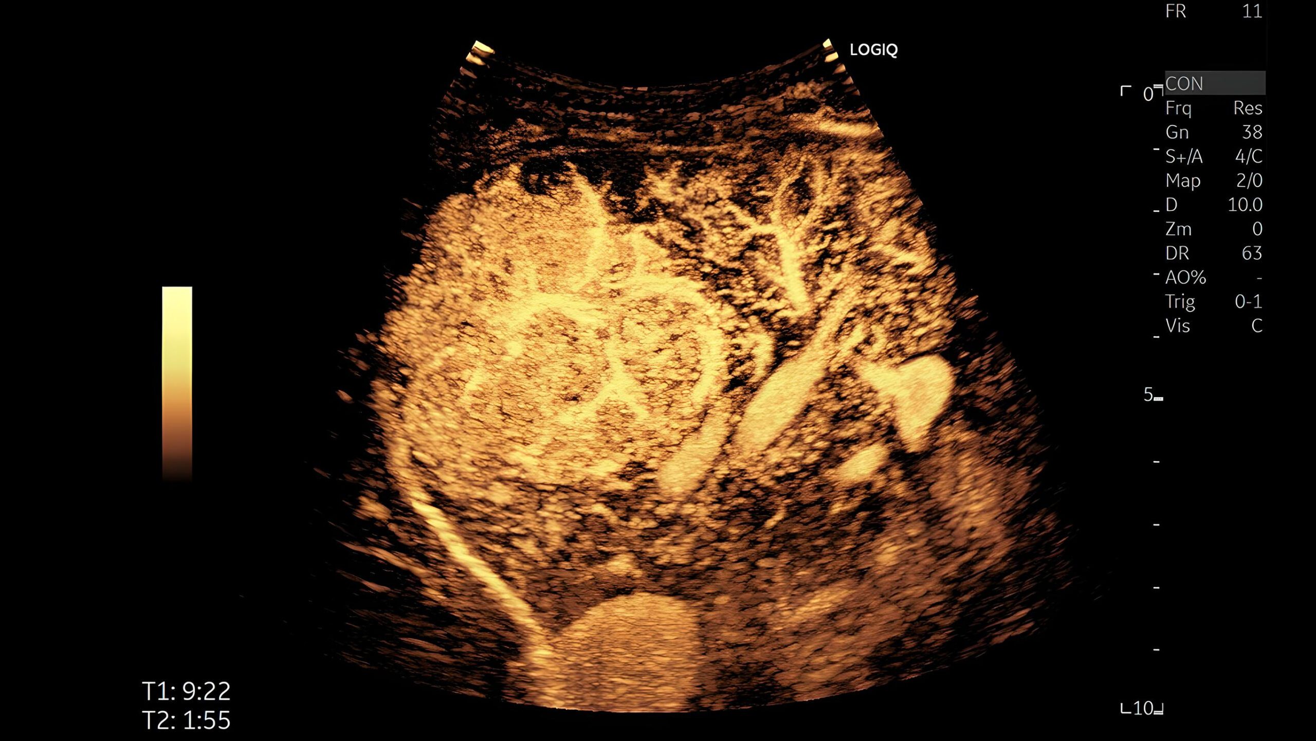 Contrast enhansed imaging, C1-6-D
