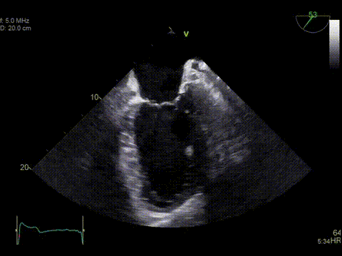 True Confocal Imaging