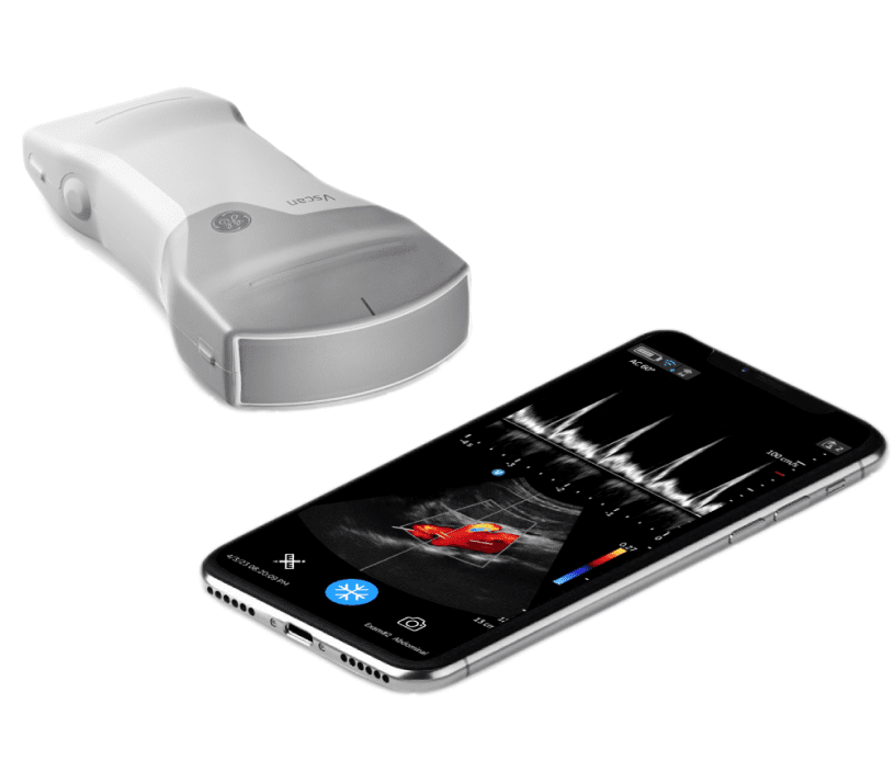 Ультрапортативний апарат УЗД Vscan Air CL
