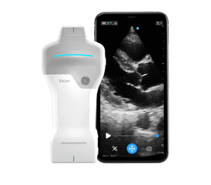 Ультрапортативна УЗД сиситема Vscan Air SL