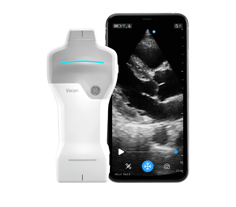 Ультрапортативна УЗД сиситема Vscan Air SL