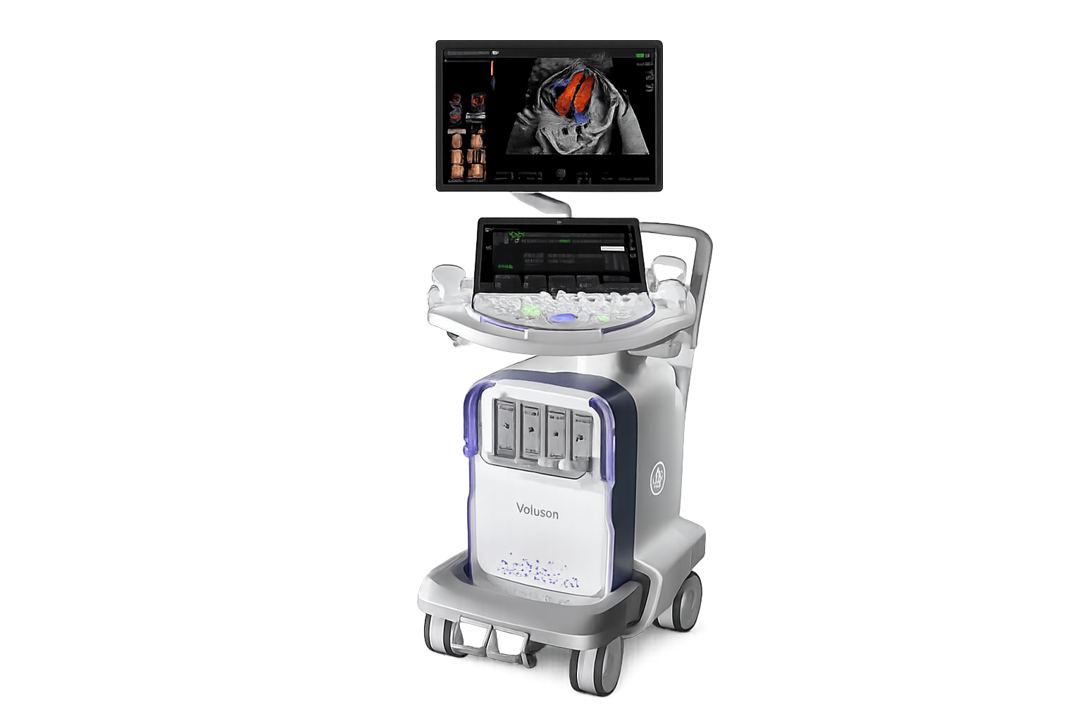 Voluson Expert 22/Expert 20 — інноваційна УЗД-система для жіночого здоров’я