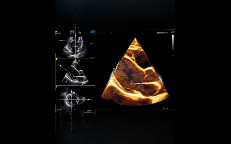 Structural Heart Package