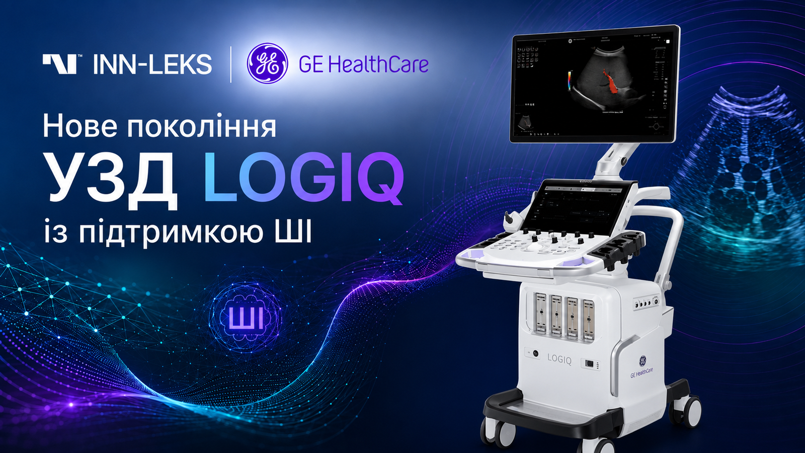GE HealthCare представила нове покоління УЗД-систем LOGIQ із підтримкою ШІ