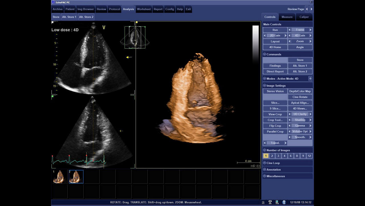 True Scan Raw Data