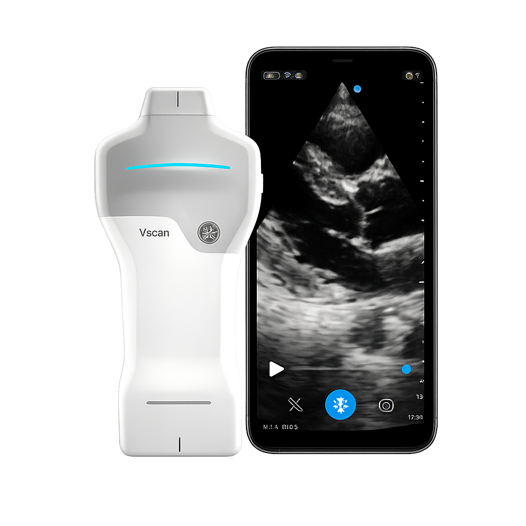 Ультрапортативний УЗД Vscan Air SL